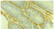 AM33006PU-N - Collagen type IV