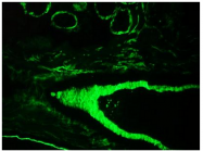 AM33010PU-N - CD104 / Integrin beta-4