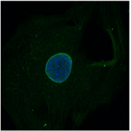 AM33013PU-N - Nesprin-3