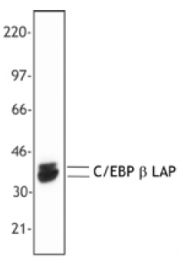 AM33044PU-S - CEBPB