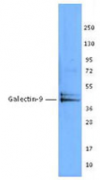 AM33065PU-N - Galectin-9