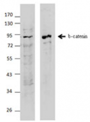 AM33102PU-S - Catenin beta-1