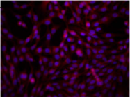 AM33102PU-S - Catenin beta-1