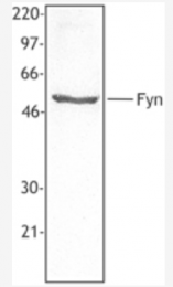 AM33106PU-S - FYN