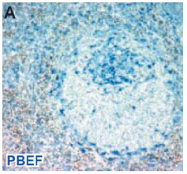 AM33114PU-N - Visfatin / NAMPT