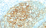 AM33117PU-T - CD106 / VCAM1
