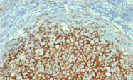 AM33117PU-T - CD106 / VCAM1