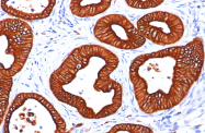 AM33119PU-T - Cytokeratin 18