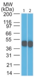 AM33119PU-T - Cytokeratin 18
