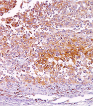 AM33121PU-T - Melanoma gp100