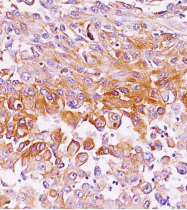 AM33121PU-T - Melanoma gp100