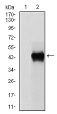 AM33172PU-N - SERPINE1 / PAI1