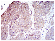 AM33173SU-N - CD104 / Integrin beta-4