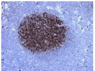 AM33192PU-N - CD10 / Neprilysin
