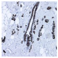 AM33198SU-N - Cytokeratin 19