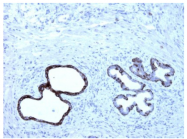 AM33199SU-N - Cytokeratin 5