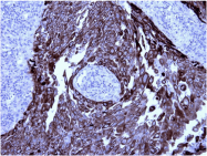 AM33199SU-N - Cytokeratin 5