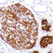 AM33218PU-M - CD10 / Neprilysin