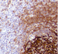 AM33220PU-S - CD21