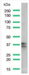 AM33222PU-S - Nucleophosmin