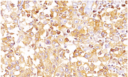 AM33241SU-S - Melanoma gp100