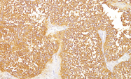 AM33241SU-S - Melanoma gp100