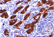 AM33242PU-T - Thyroglobulin