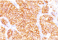 AM33258PU-T - Carbonic anhydrase 9