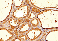 AM33262PU-T - Thyroglobulin