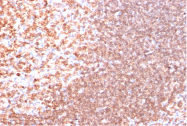 AM33264PU-T - CD74