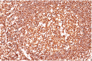 AM33266PU-N - CD45 / LCA