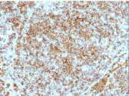 AM33267PU-T - CD45 / LCA