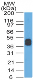 AM33271PU-N - acidic Cytokeratin