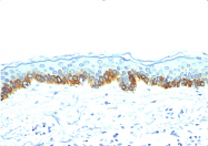 AM33271PU-N - acidic Cytokeratin