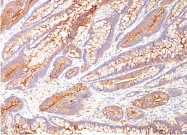 AM33274PU-S - CD66e / CEACAM5