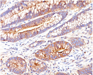 AM33275PU-N - CD66e / CEACAM5