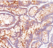 AM33276PU-T - CD66e / CEACAM5