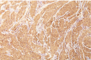 AM33291PU-T - Actin