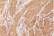 AM33291PU-T - Actin