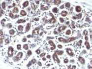 AM33297PU-T - Trefoil factor 1 / pS2