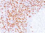 AM33320PU-T - CD8