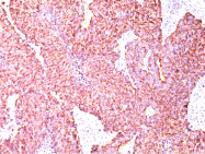 AM32789PU-S - Chromogranin A