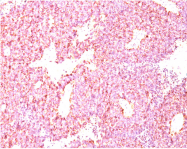 AM33328PU-S - Chromogranin A