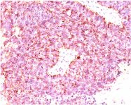 AM33329PU-T - Chromogranin A