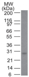 AM33344PU-T - Bcl-2