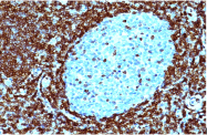 AM33344PU-T - Bcl-2