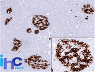AM33363PU-S - Insulin