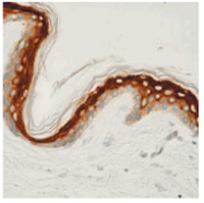 AM33368PU-T - Involucrin / IVL
