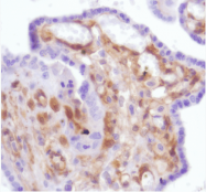 AM33389PU-S - Galectin-1