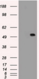 AM33397PU-N - Alpha-1-antitrypsin